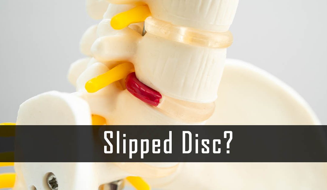 What is a Bulging Disc? | The Truth About Slip Discs